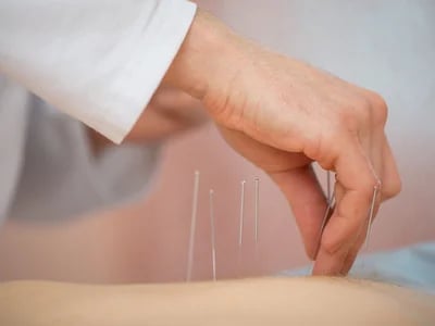 Akupunktura és a szív egészsége – Akupunkturbehandlungen usw magyarázata