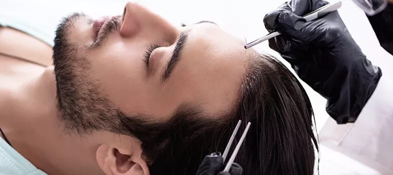 Beste haartransplantation und Technologie: Die neuesten Fortschritte