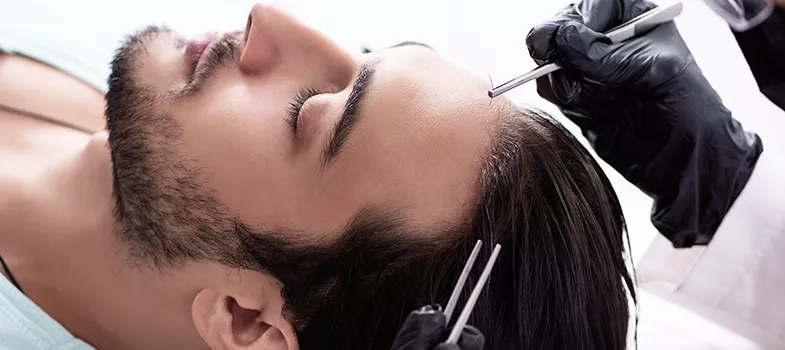 Beste haartransplantation und Technologie: Die neuesten Fortschritte
